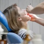 Comprehensive Guide to Wisdom Tooth Surgery Process, Recovery, and FAQs